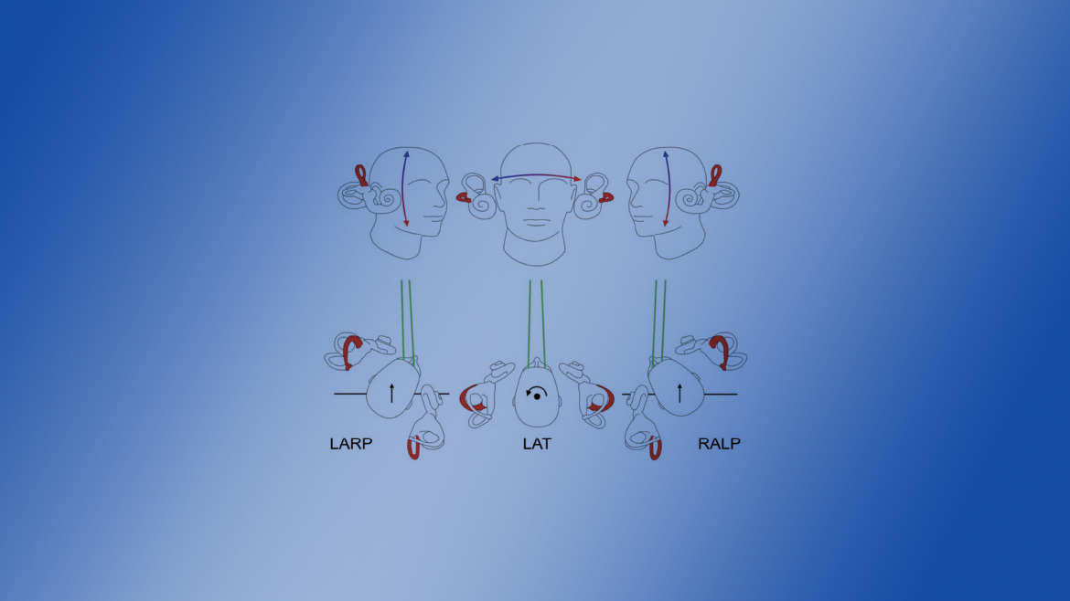 Vidéo head impulse test (VIHT)